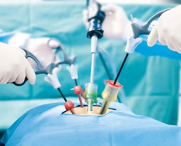 minimally invasive surgical procedure